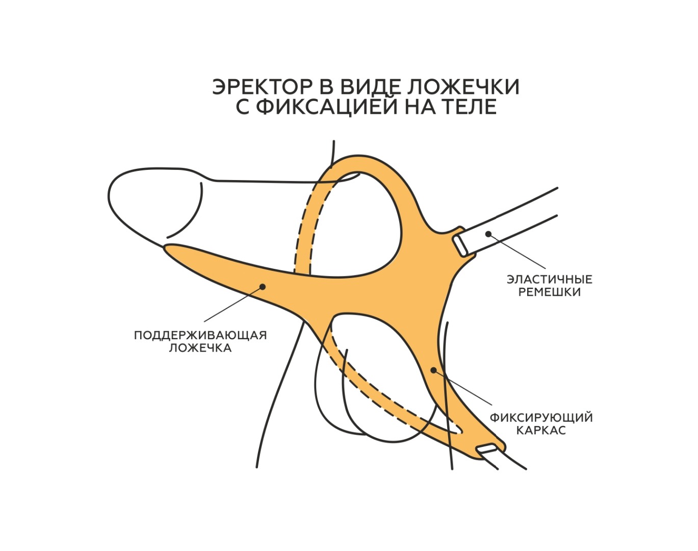 Эректор - полужёсткая поддерживающая "ложечка", Светлый